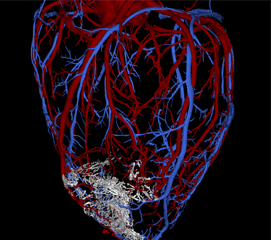 Image of a scaffold on a heart