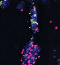 Titanium-based materials fight oral bacteria, lead to new patent