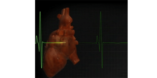 Illustration of heart and cardiogram