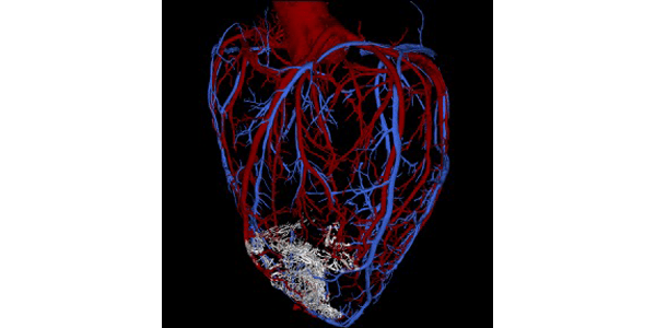 Regenerated heart muscle (white)