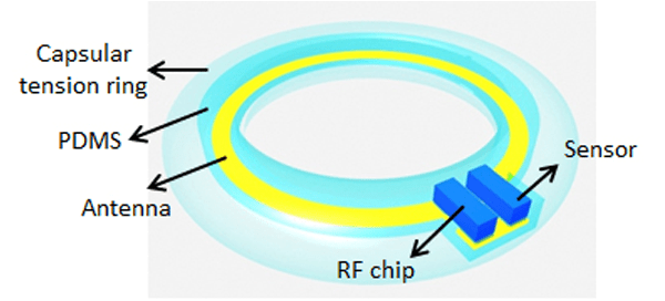 Illustration of device, containing artificial lens, sensor and RF chip