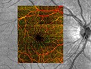 imaging of eye vasculature