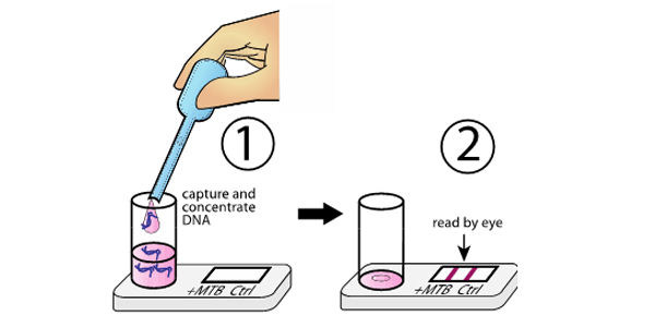 Illustration demonstrating how diagnostic device detects tuberculosis from urine