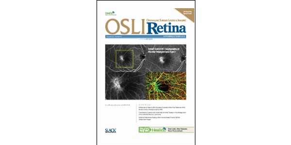 UW Bioengineering Professor Ruikang Wang's research featured on cover of OSLI Retina journal