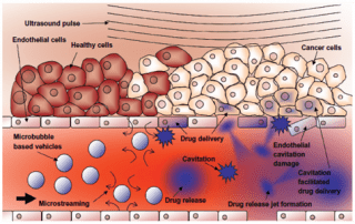 Averkiou ultrasound mediated drug delivery