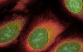 A composite image of HeLa cells stained sequentially with antibodies to five different proteins.