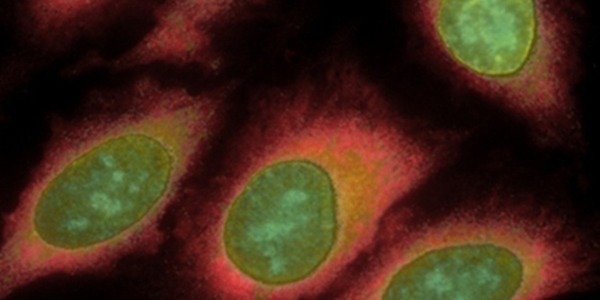 A composite image of HeLa cells stained sequentially with antibodies to five different proteins.
