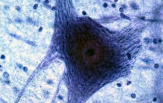 A micrograph of a motor neuron cell showing its extended fibers.