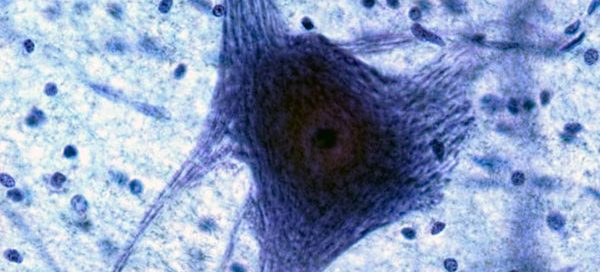 A micrograph of a motor neuron cell showing its extended fibers.