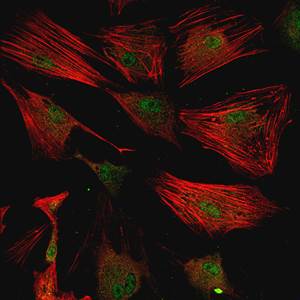 Jennifer Davis fibroblast cells