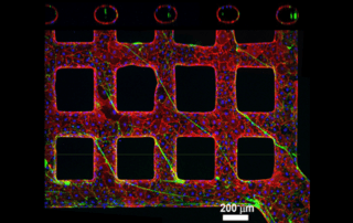 vWF secretion and fiber assembly in a microvessel