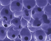 porous scaffold material Ratner