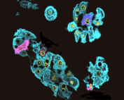 Liver cells, Kelly Stevens lab