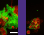 Daggett Lab E Coli Research
