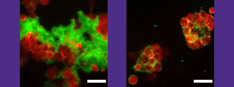 Daggett Lab E Coli Research