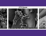 Scanning electron microscopy images of the bacterial biofilms on untreated cotton gauze (left), gauze with layer-by-layer coatings of chitosan and alginate (CT5, middle), and with further addition of alpha-sheet peptide (CT5+AP gauze, right). There is over a 600-fold decrease in the bacterial biofilms with the alpha-sheet peptide-treated gauze.