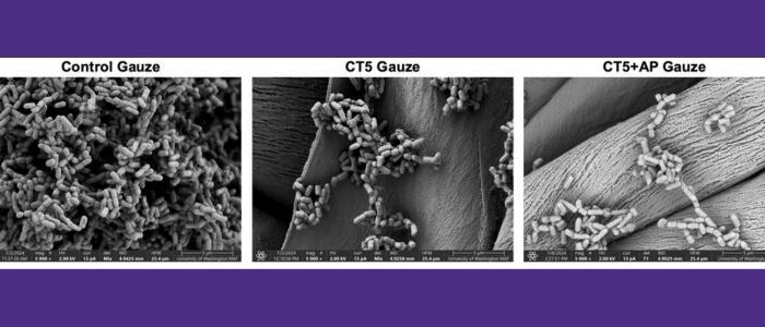 Scanning electron microscopy images of the bacterial biofilms on untreated cotton gauze (left), gauze with layer-by-layer coatings of chitosan and alginate (CT5, middle), and with further addition of alpha-sheet peptide (CT5+AP gauze, right). There is over a 600-fold decrease in the bacterial biofilms with the alpha-sheet peptide-treated gauze.