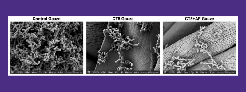 Scanning electron microscopy images of the bacterial biofilms on untreated cotton gauze (left), gauze with layer-by-layer coatings of chitosan and alginate (CT5, middle), and with further addition of alpha-sheet peptide (CT5+AP gauze, right). There is over a 600-fold decrease in the bacterial biofilms with the alpha-sheet peptide-treated gauze.