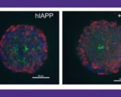 Cell showing areas with DNA, insulin and amyloid