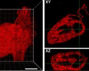 Cole DeForest patterned heart images