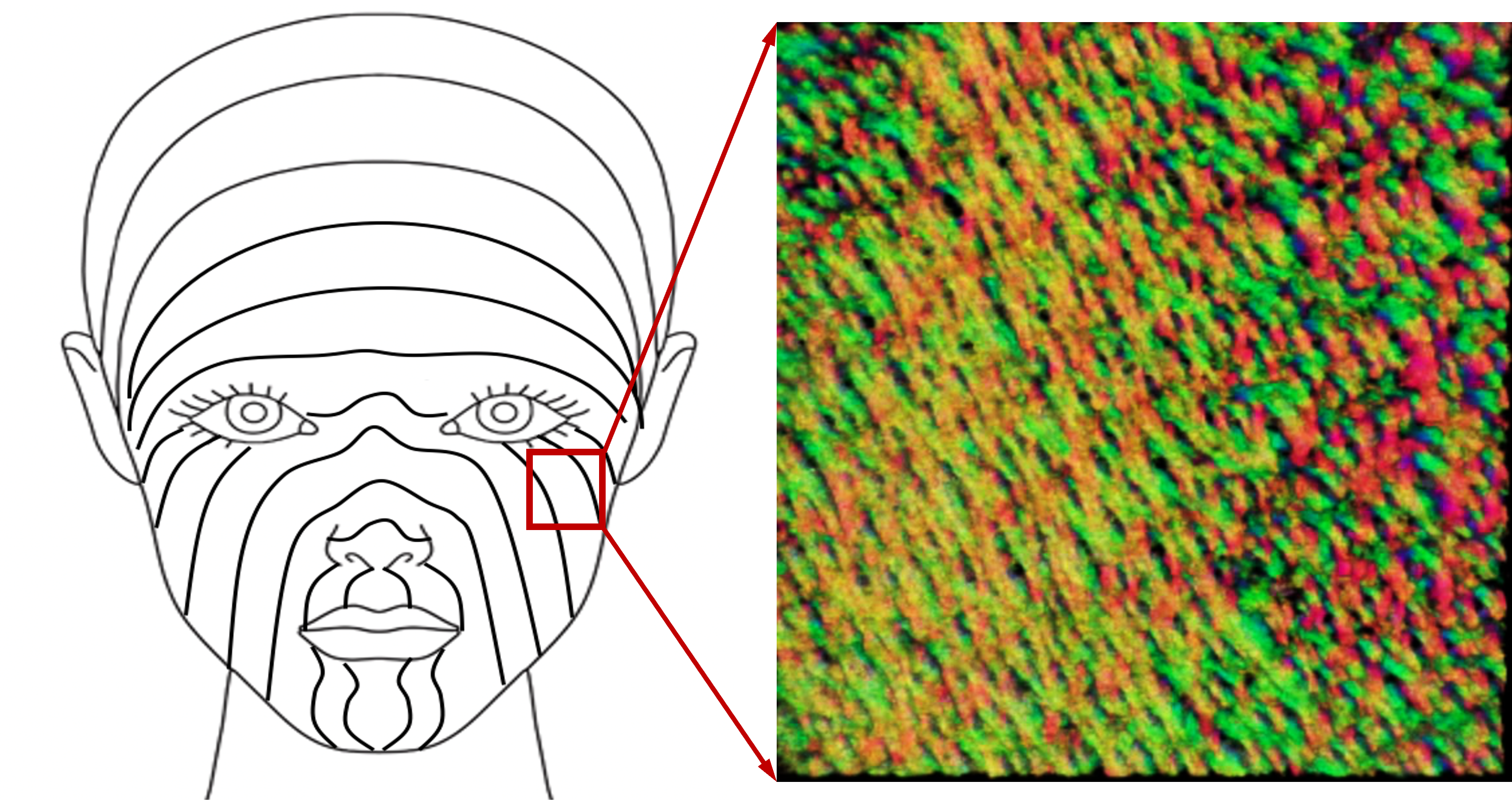 Drawing of tension lines of face and medical imaging of collagen structure under skin 