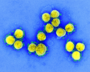 SARS-CoV-2 blue and yellow