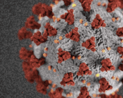 SARS-CoV-2 particle