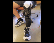 leg with prosthetic socket
