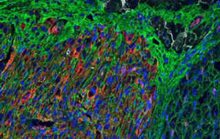 Cardiomyocyte image from Stem Cell Reports