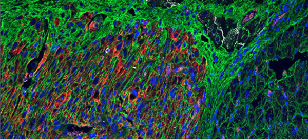 Cardiomyocyte image from Stem Cell Reports