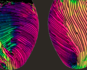 colorful medical image showing collagen structure in two rat hearts