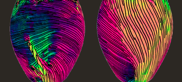 colorful medical image showing collagen structure in two rat hearts