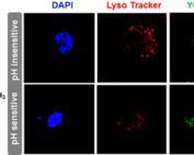 In vitro cellular uptake of YOYO-1 labeled DNA delivered by IP and SP.