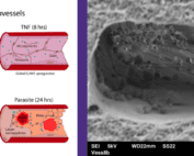 3D Brain Microvessels