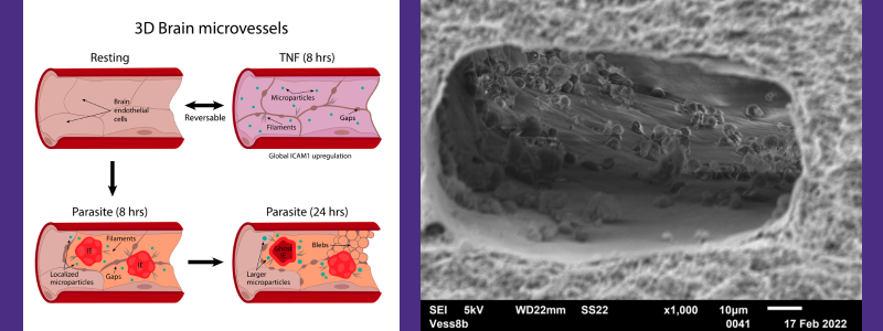 3D Brain Microvessels