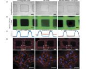Human umbilical vein endothelial cell (HUVEC) microvessels perfused with sera from children with cerebral malaria (CM) illustrate greater dextran leak versus sera control, which can be prevented with preincubation with miR-155 antagomir.