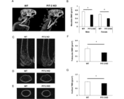 Global PiT-2 homozygous knockout mice exhibit reduced bone and tissue mineral density