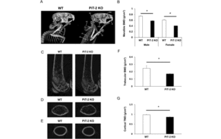 Global PiT-2 homozygous knockout mice exhibit reduced bone and tissue mineral density