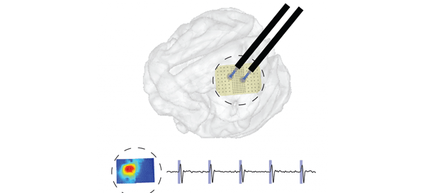 Large scale brain stimulation device
