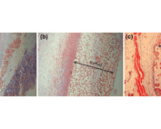 Masson's trichrome stain of tissue sample after 3 weeks implantation. (a) 40-µm PDMS scaffold; (b) 40-µm pHEMA scaffold; (c) 90-µm PDMS scaffold. Scale Bar?=?100??m