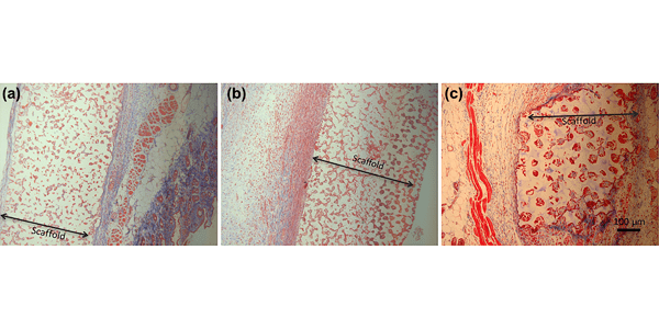 Masson's trichrome stain of tissue sample after 3 weeks implantation. (a) 40-µm PDMS scaffold; (b) 40-µm pHEMA scaffold; (c) 90-µm PDMS scaffold. Scale Bar?=?100??m