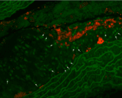 Runx2 in athersclerotic blood vessels