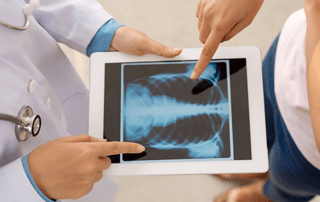 Physician and patient examining chest xray on a tablet
