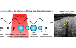 A new contrast agent for combined photoacoustic and ultrasound imaging is presented.