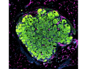 Microscopic image of a liver tissue seed grown in a mouse