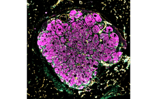 Liver "seed" growing in mouse liver disease model