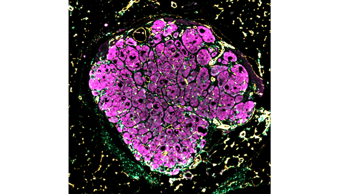 Liver "seed" growing in mouse liver disease model