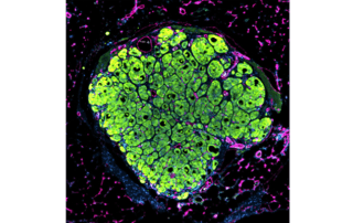 Microscopic image of a liver tissue seed grown in a mouse