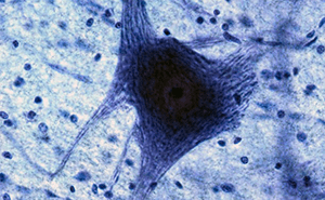 A micrograph of a motor neuron cell showing its extended fibers.