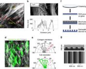 Nanopatterned substrates mimic aligned collagen architectures in breast and pancreas cancer